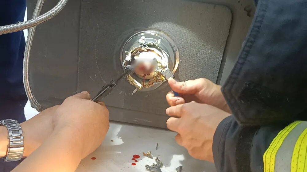 鲜血直流!厨房这个地方利如刀片,不要伸进去! 鲜血直流!厨房这个地方利如刀片,不要伸进去!