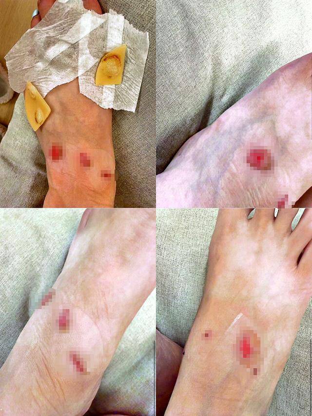 女子购万元LV运动鞋双脚多处破皮要求退款被拒 客服:只能换(图4)