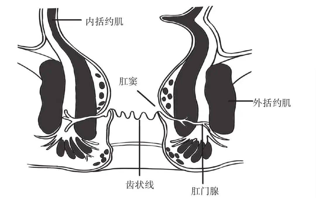【科普】肛窦炎全面科普指南_粪便_肛门_炎症