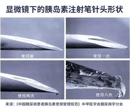 忽略这 5 个细节，等于胰岛素白打！糖友速看避坑