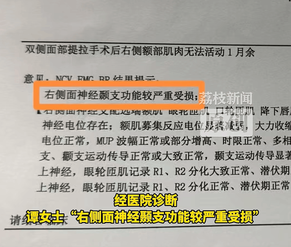 女子花8万元做医美后右脸面瘫 颜净医美:或是术后正常反应(图2)