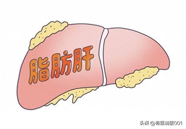 瘦人也会得脂肪肝？比胖子更隐蔽更危险！这个千年疏肝方从根调