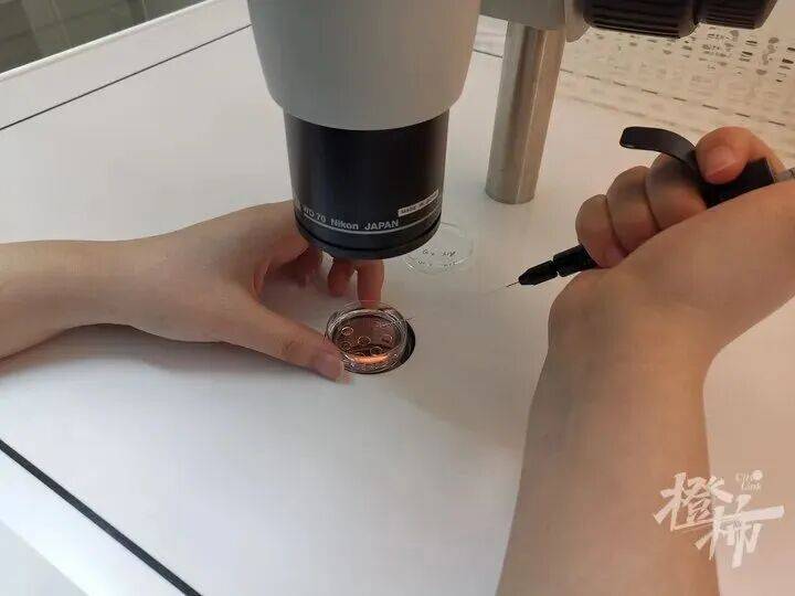 张钧甯自曝已完成冻卵手术